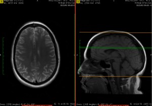 Magnetic resonance imaging (MRI) is the topic of discussion.